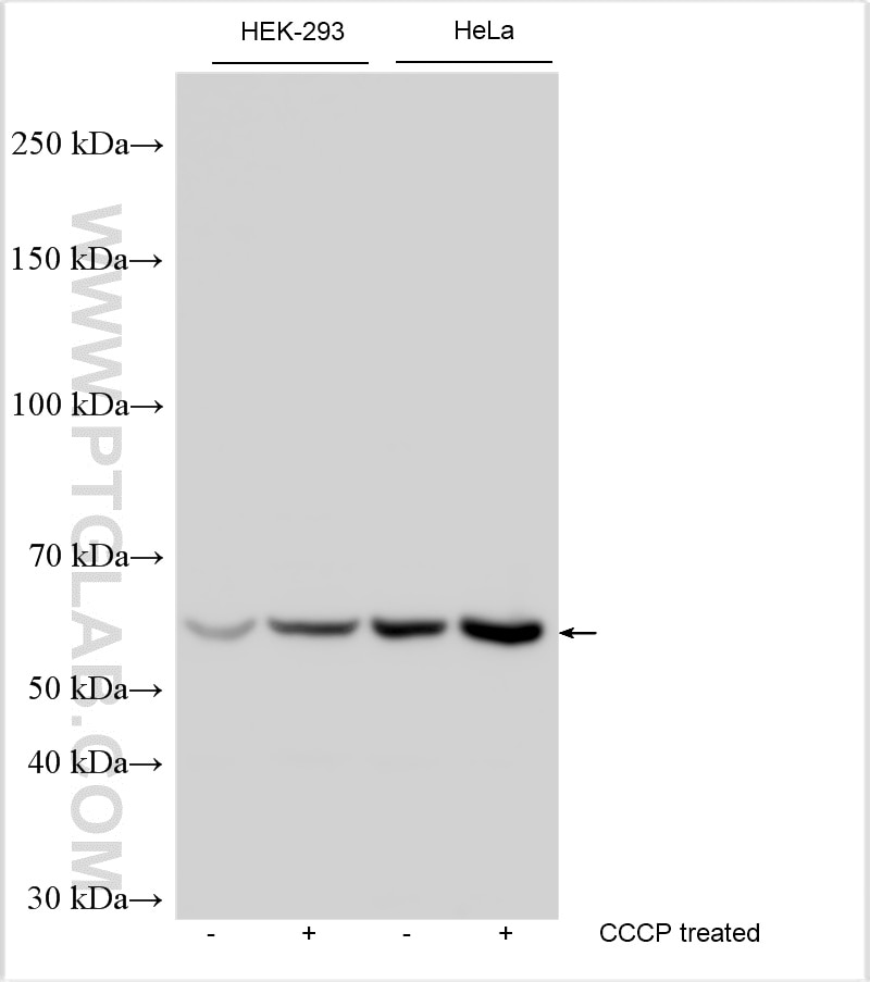 Western Blot (WB) analysis of various lysates using PINK1 Polyclonal antibody (23274-1-AP)