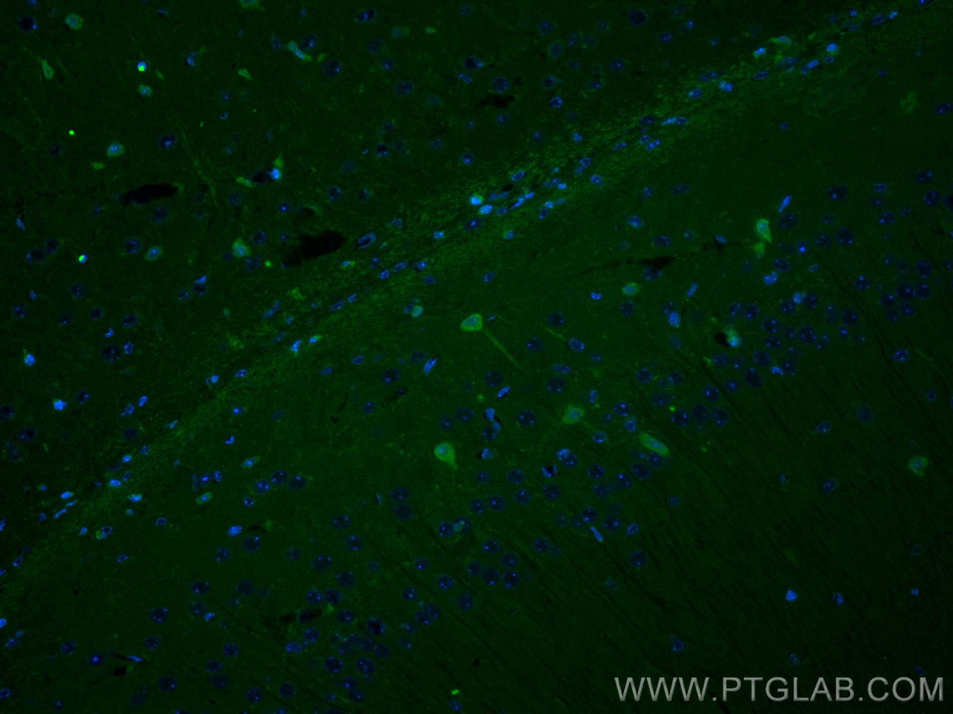 Immunofluorescence (IF) / fluorescent staining of mouse brain tissue using CoraLite® Plus 488-conjugated PINK1 Polyclonal ant (CL488-23274)