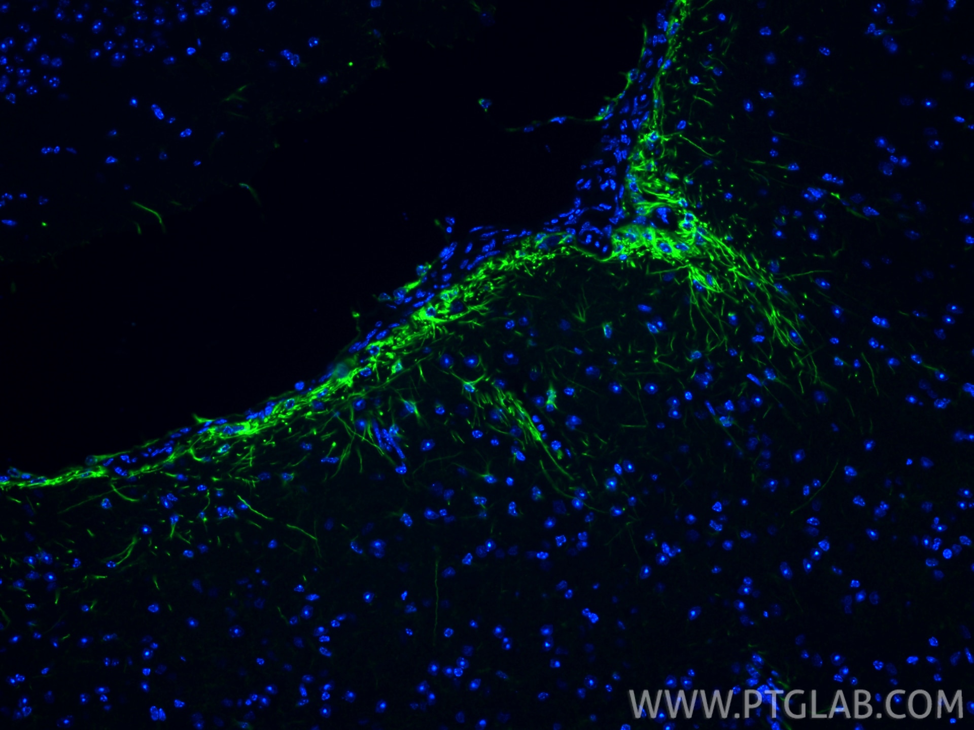 Immunofluorescence (IF) / fluorescent staining of mouse brain tissue using CoraLite® Plus 488-conjugated PINK1 Recombinant an (CL488-81991-4)