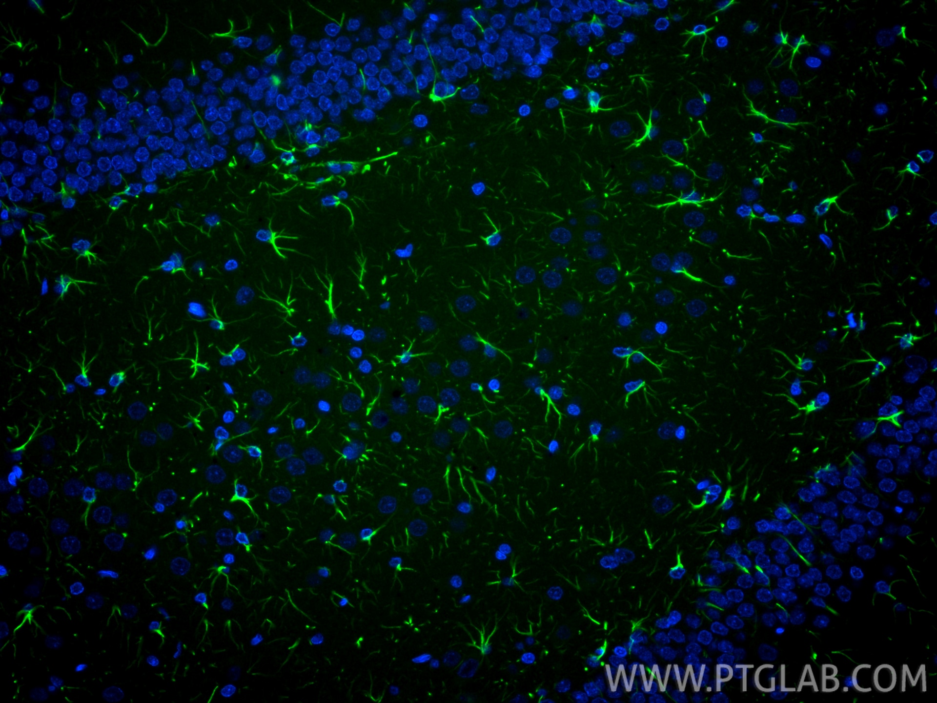 Immunofluorescence (IF) / fluorescent staining of rat brain tissue using CoraLite® Plus 488-conjugated PINK1 Recombinant an (CL488-81991-4)
