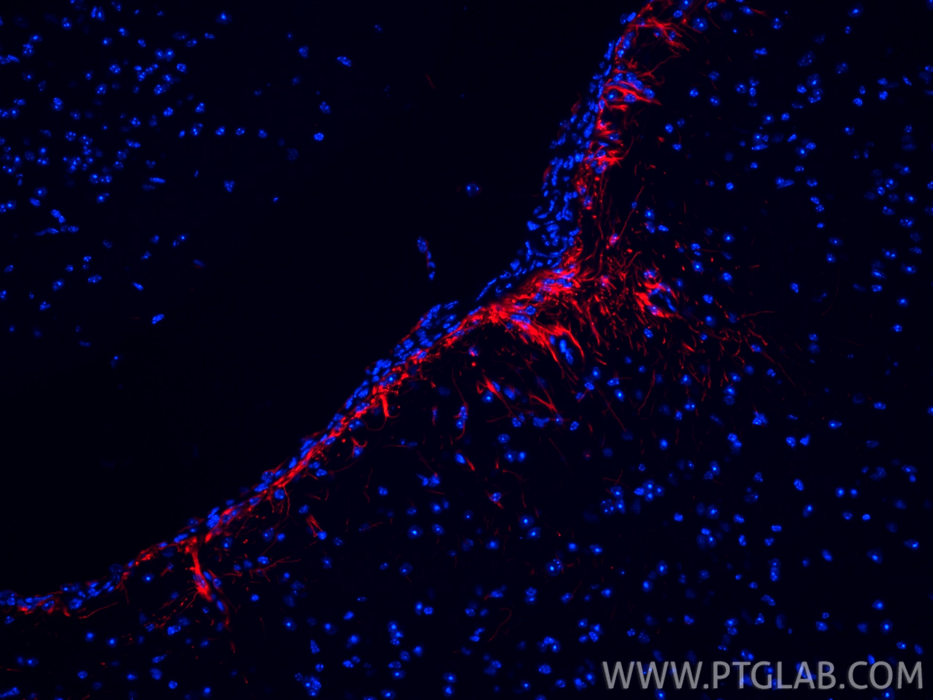 Immunofluorescence (IF) / fluorescent staining of mouse brain tissue using CoraLite®594-conjugated PINK1 Recombinant antibody (CL594-81991-4)