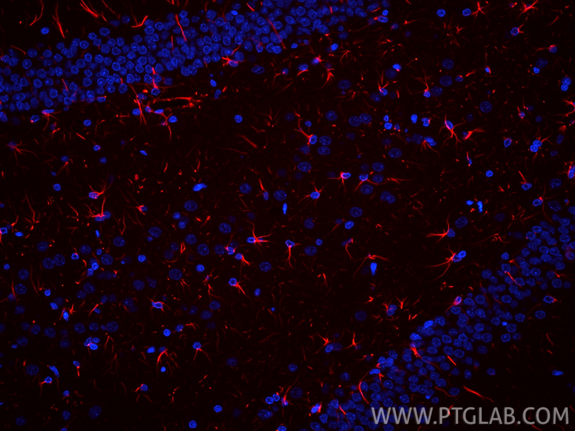 Immunofluorescence (IF) / fluorescent staining of rat brain tissue using CoraLite®594-conjugated PINK1 Recombinant antibody (CL594-81991-4)