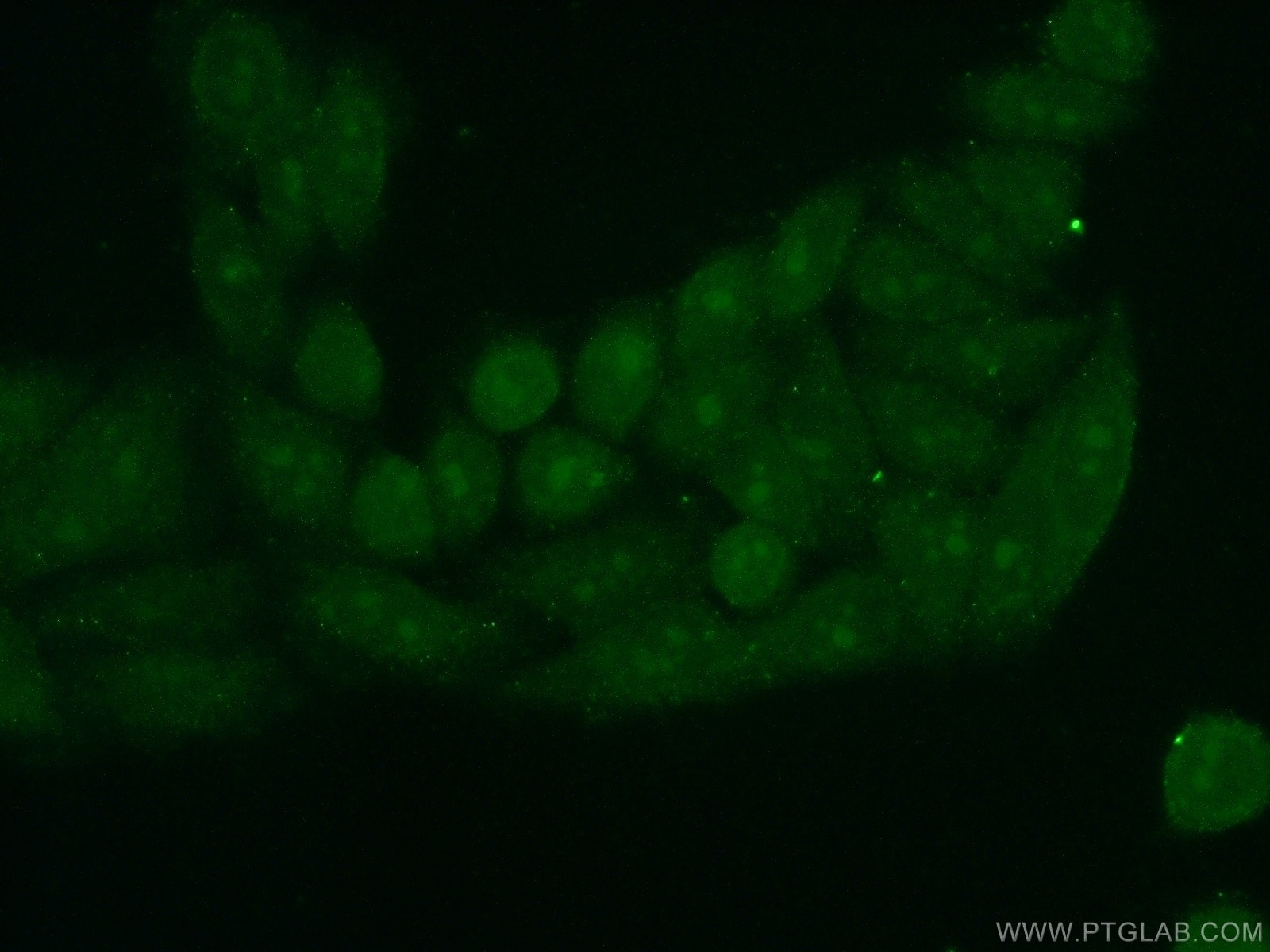 Immunofluorescence (IF) / fluorescent staining of HeLa cells using PINX1 Polyclonal antibody (12368-1-AP)