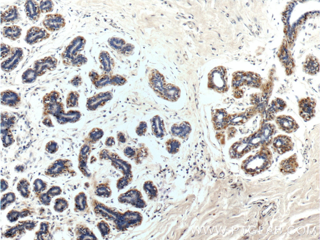 Immunohistochemistry (IHC) staining of human breast tissue using GCDFP-15/PIP Polyclonal antibody (16068-1-AP)