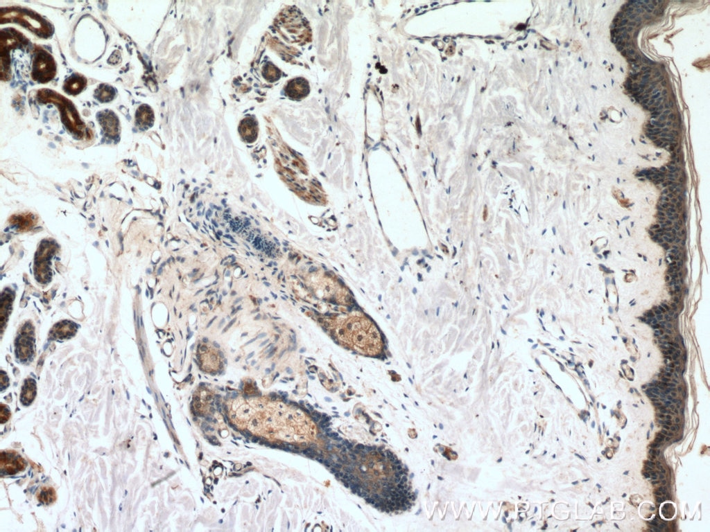 Immunohistochemistry (IHC) staining of human skin tissue using GCDFP-15/PIP Polyclonal antibody (16068-1-AP)