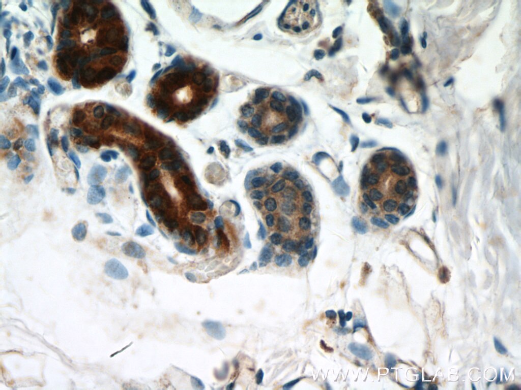 Immunohistochemistry (IHC) staining of human skin tissue using GCDFP-15/PIP Polyclonal antibody (16068-1-AP)
