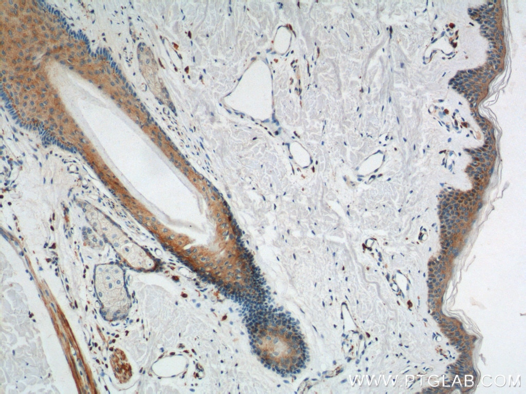 IHC staining of human skin using 60210-1-Ig Immunohistochemistry (IHC) staining of human skin tissue using GCDFP-15/PIP Monoclonal antibody (60210-1-Ig)