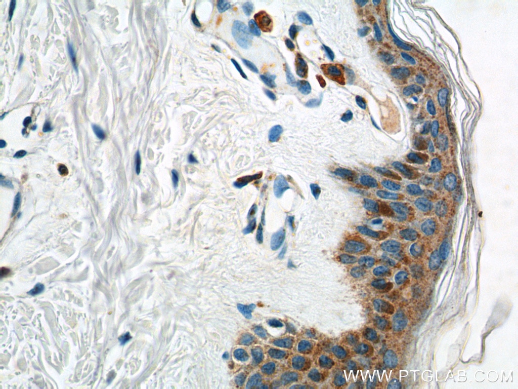 IHC staining of human skin using 60210-1-Ig Immunohistochemistry (IHC) staining of human skin tissue using GCDFP-15/PIP Monoclonal antibody (60210-1-Ig)