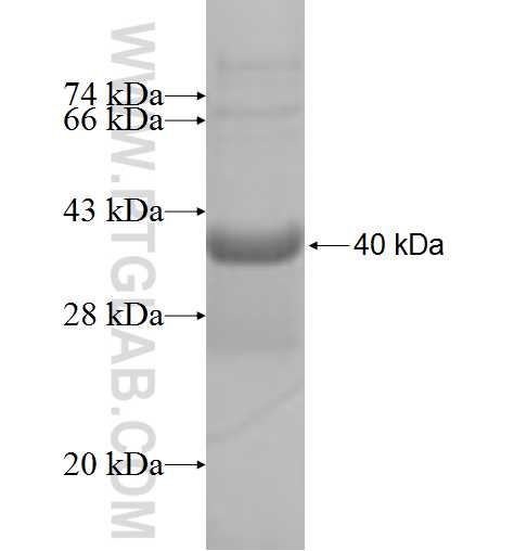 GCDFP-15, PIP fusion protein Ag9004 SDS-PAGE