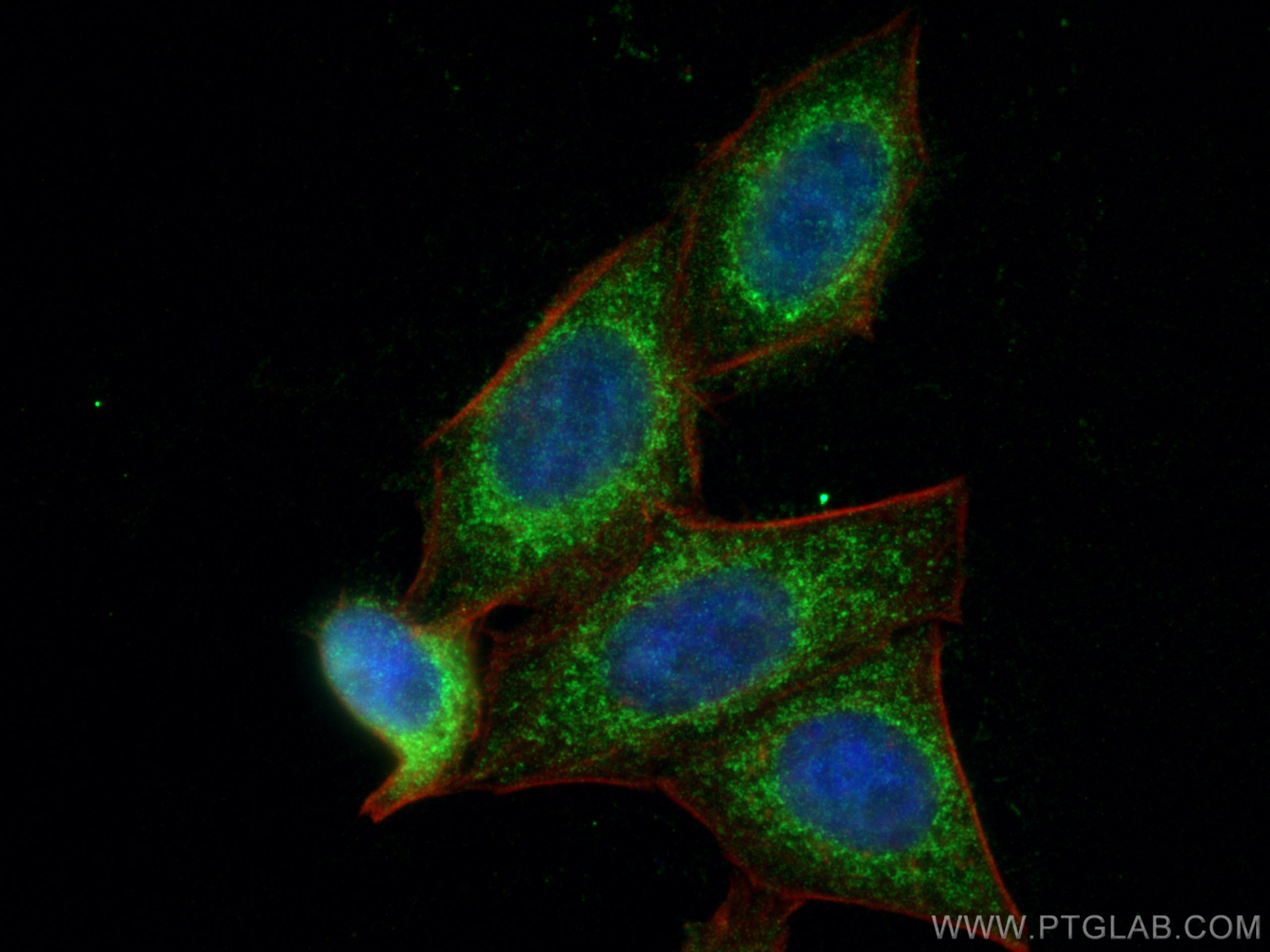 Immunofluorescence (IF) / fluorescent staining of HepG2 cells using PIP4K2A Polyclonal antibody (12469-1-AP)