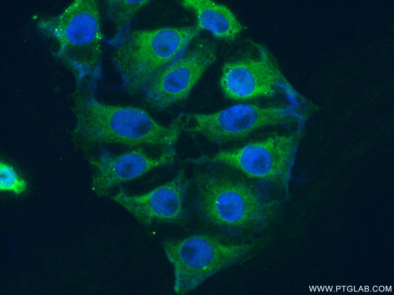 Immunofluorescence (IF) / fluorescent staining of SH-SY5Y cells using PIP4K2A Polyclonal antibody (12469-1-AP)