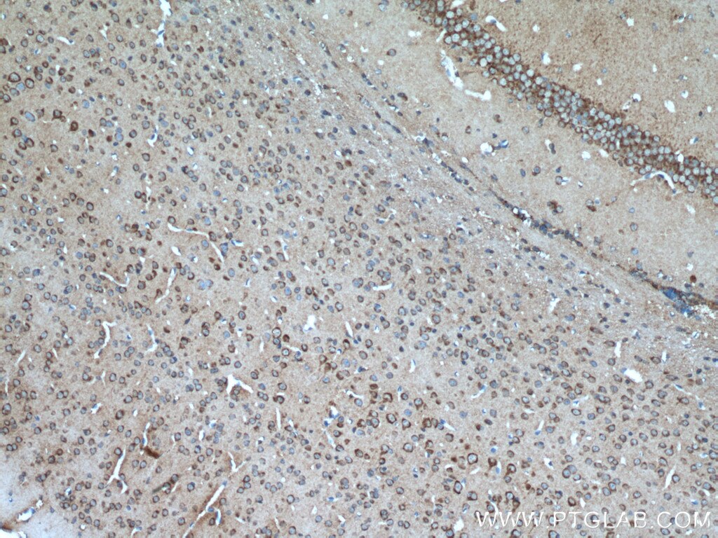 Immunohistochemistry (IHC) staining of mouse brain tissue using PIP4K2A Polyclonal antibody (12469-1-AP)