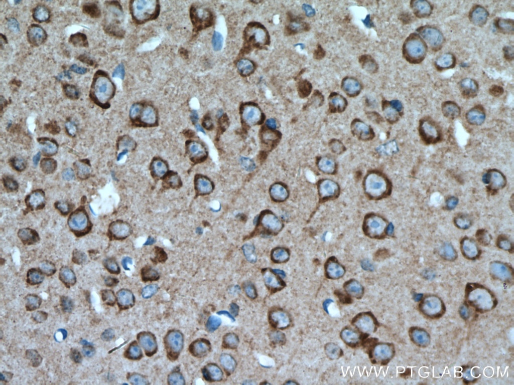 Immunohistochemistry (IHC) staining of mouse brain tissue using PIP4K2A Polyclonal antibody (12469-1-AP)
