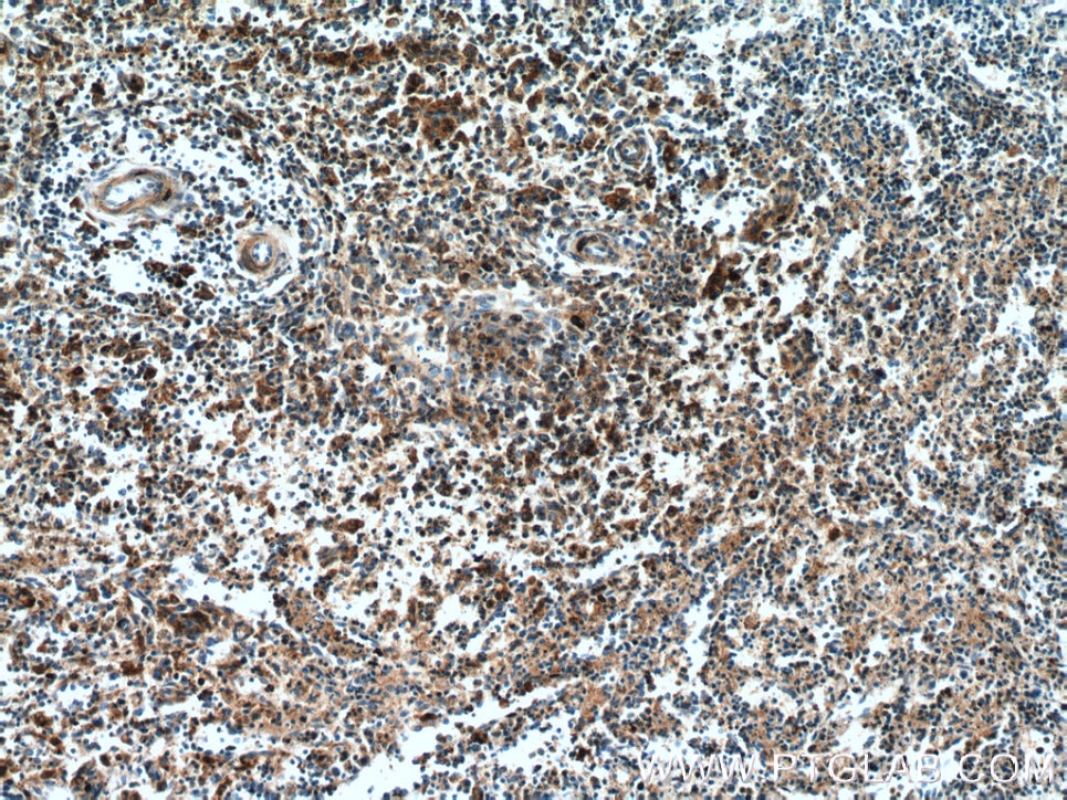 IHC staining of human spleen using 12469-1-AP