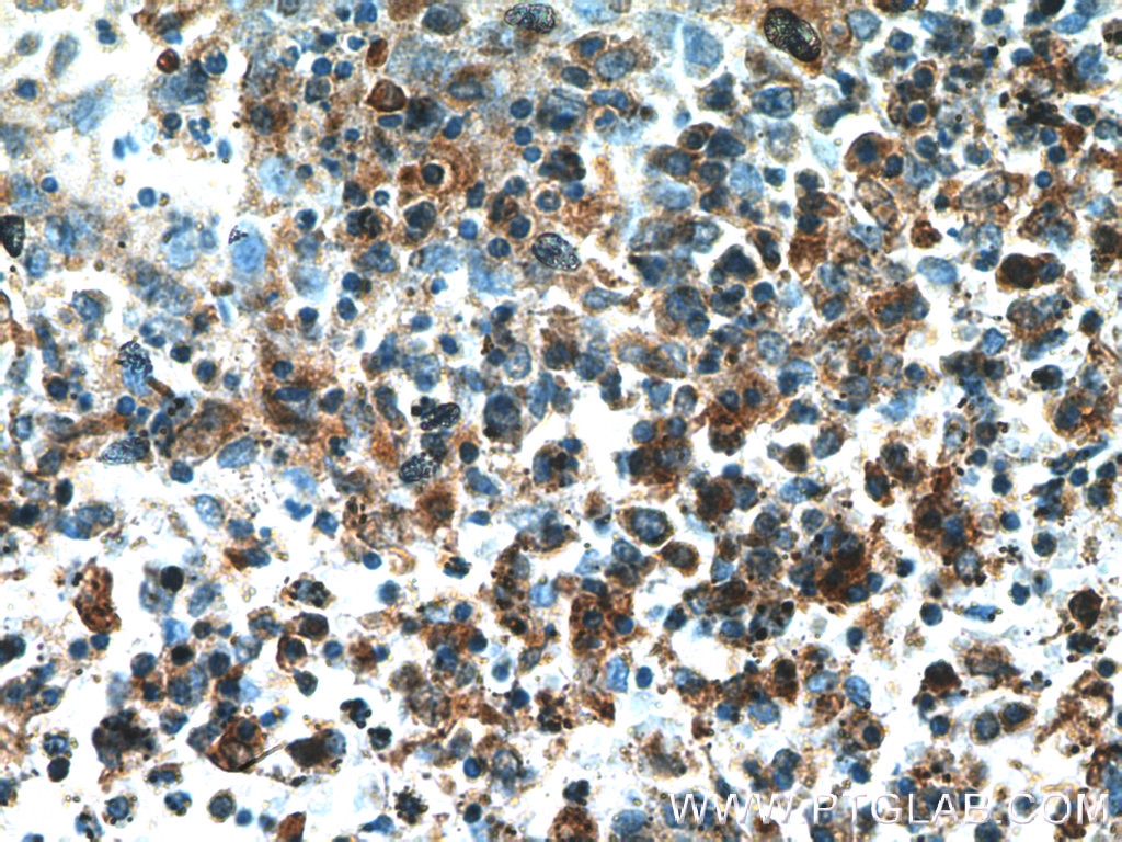 Immunohistochemistry (IHC) staining of human spleen tissue using PIP4K2A Polyclonal antibody (12469-1-AP)