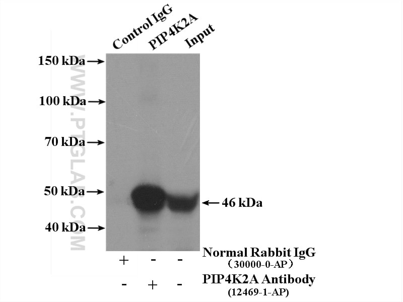Immunoprecipitation (IP) experiment of mouse brain tissue using PIP4K2A Polyclonal antibody (12469-1-AP)