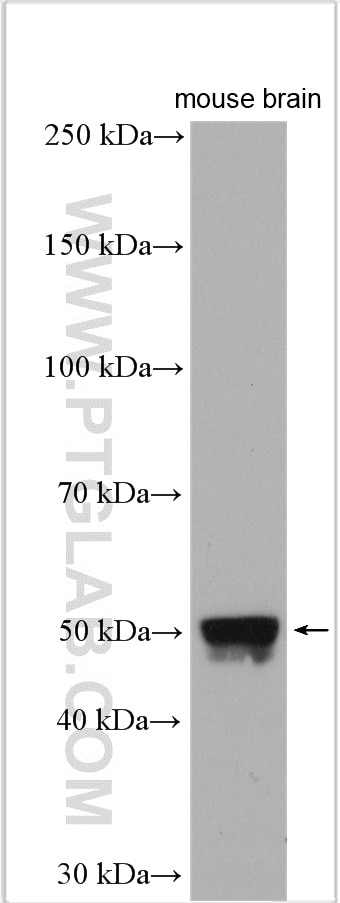 Western Blot (WB) analysis of mouse brain tissue using PIP4K2A Polyclonal antibody (12469-1-AP)