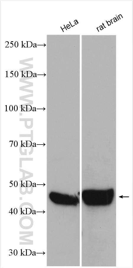 Western Blot (WB) analysis of various lysates using PIP4K2A Polyclonal antibody (12469-1-AP)