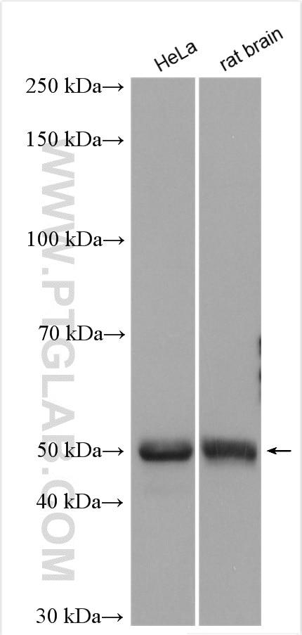 Western Blot (WB) analysis of various lysates using PIP4K2A Polyclonal antibody (12469-1-AP)
