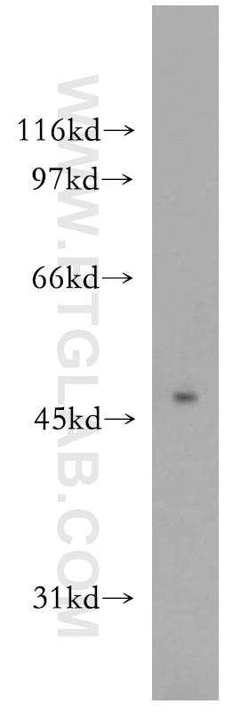 Western Blot (WB) analysis of mouse brain tissue using PIP4K2A Polyclonal antibody (12469-1-AP)