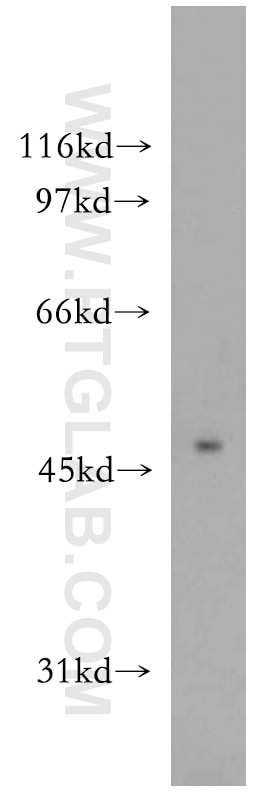 Western Blot (WB) analysis of mouse brain tissue using PIP4K2A Polyclonal antibody (12469-1-AP)