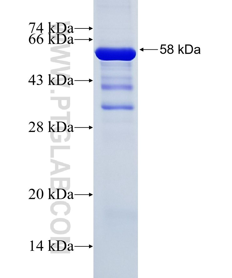 PIP4K2A fusion protein Ag25139 SDS-PAGE