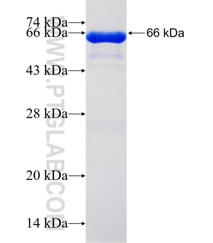 PIP4K2A fusion protein Ag3152 SDS-PAGE