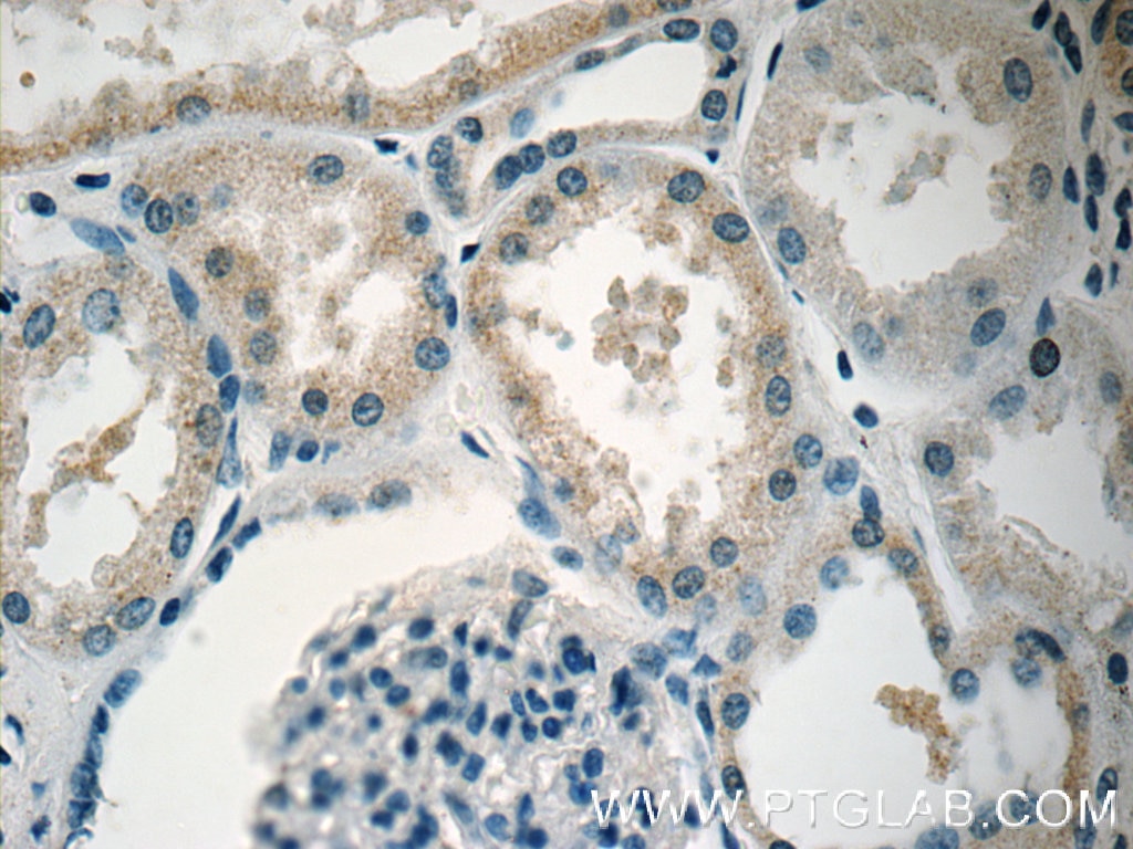 Immunohistochemistry (IHC) staining of human kidney tissue using PIP4K2B Polyclonal antibody (13218-1-AP)