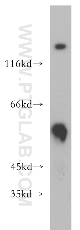Western Blot (WB) analysis of HeLa cells using PIP4K2B Polyclonal antibody (13218-1-AP)