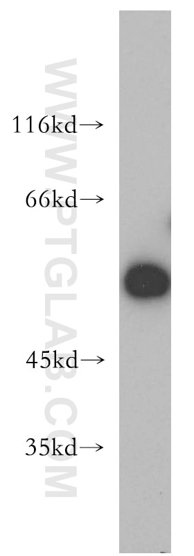 Western Blot (WB) analysis of MCF-7 cells using PIP4K2B Polyclonal antibody (13218-1-AP)