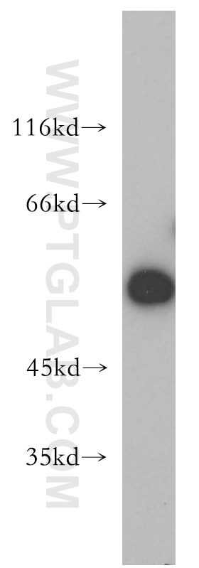 WB analysis of MCF-7 using 13218-1-AP