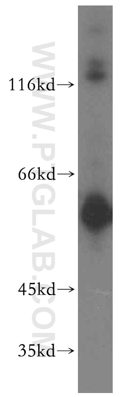 Western Blot (WB) analysis of HeLa cells using PIP4K2B Polyclonal antibody (13218-1-AP)