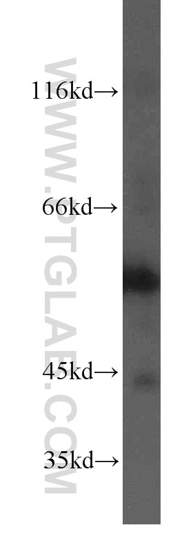 Western Blot (WB) analysis of HeLa cells using PIP4K2B Polyclonal antibody (13218-1-AP)