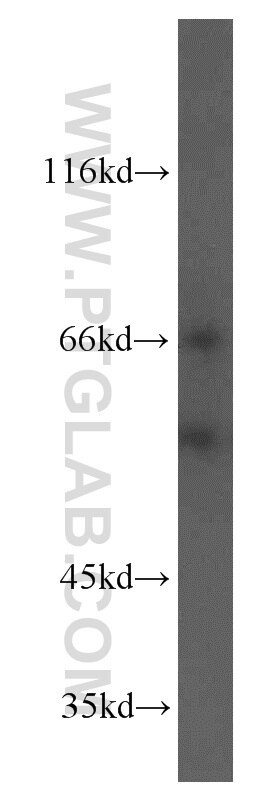 WB analysis of HeLa using 13218-1-AP