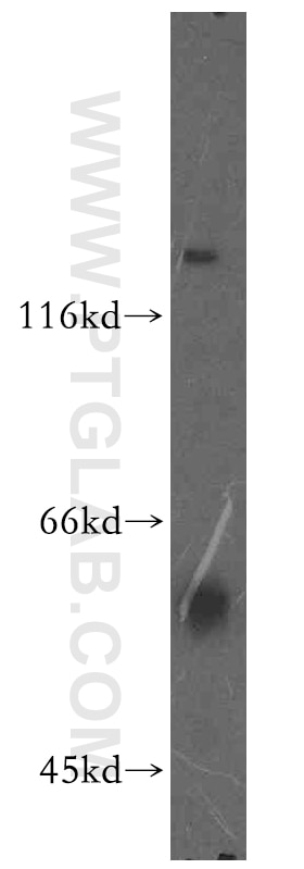 Western Blot (WB) analysis of HEK-293 cells using PIP4K2B Polyclonal antibody (13218-1-AP)
