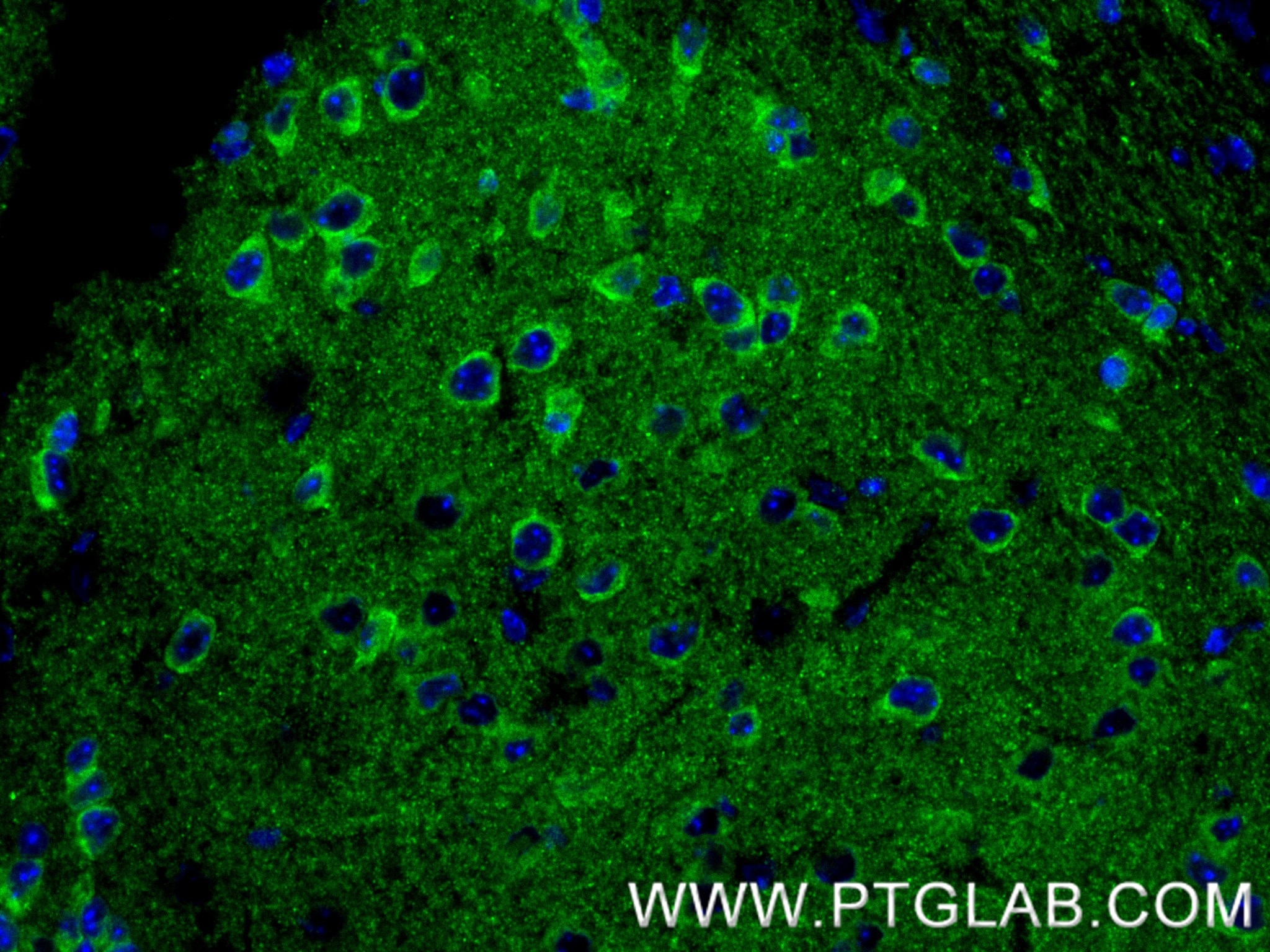 Immunofluorescence (IF) / fluorescent staining of mouse brain tissue using PIP4K2B Recombinant antibody (83647-3-RR)