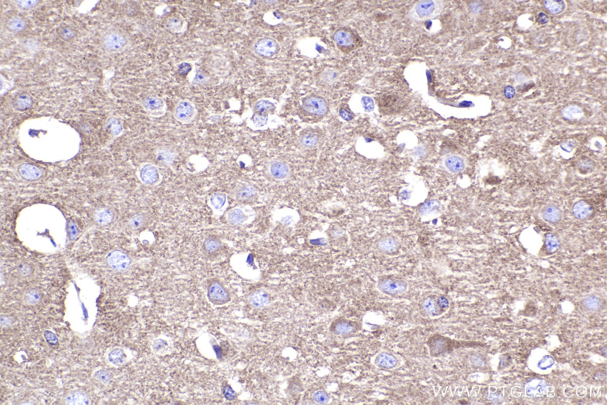 Immunohistochemistry (IHC) staining of mouse brain tissue using PIP4K2B Recombinant antibody (83647-3-RR)