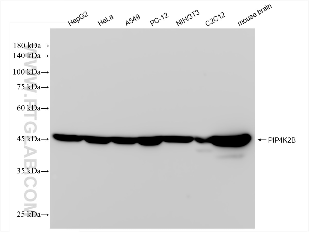 Western Blot (WB) analysis of various lysates using PIP4K2B Recombinant antibody (83647-3-RR)