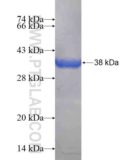 PIP4K2B fusion protein Ag14467 SDS-PAGE