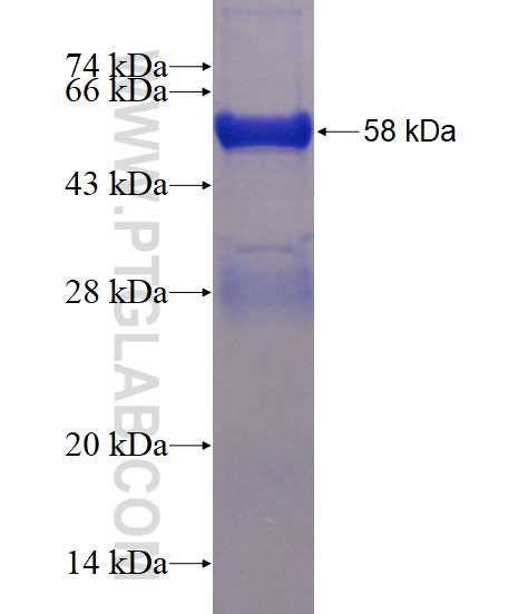 PIP4K2B fusion protein Ag4099 SDS-PAGE