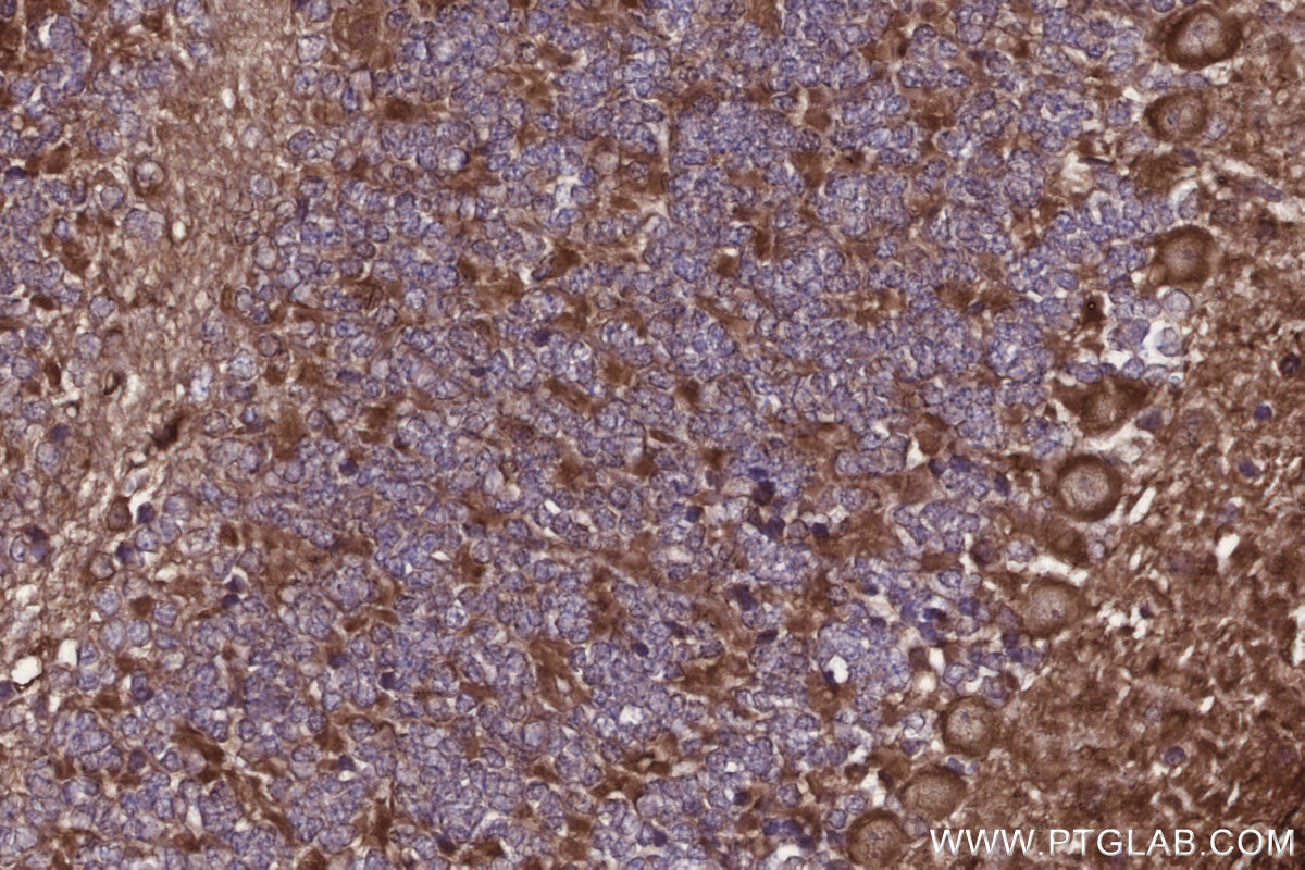 Immunohistochemistry (IHC) staining of mouse cerebellum tissue using PIP4K2C Polyclonal antibody (17077-1-AP)