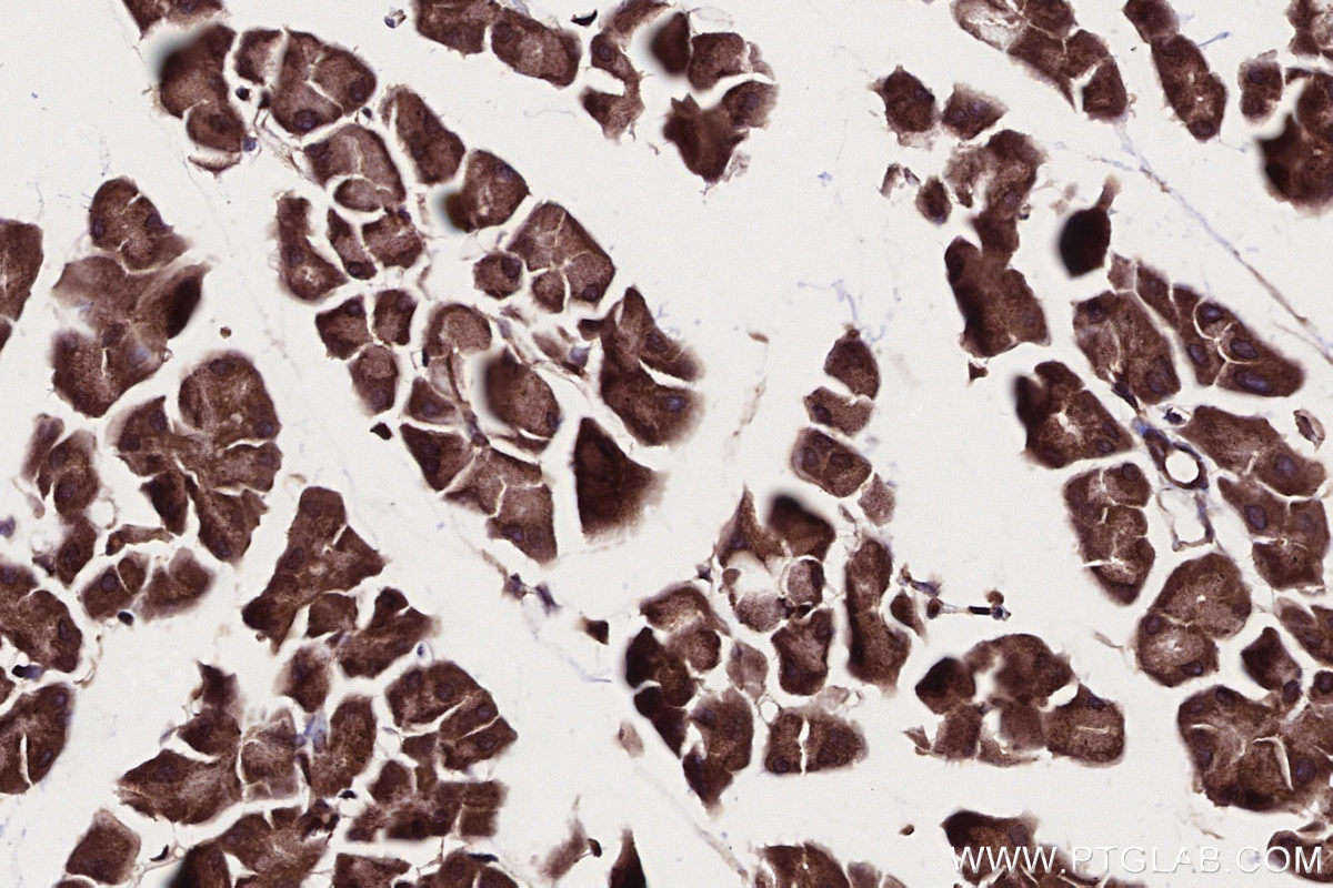 Immunohistochemistry (IHC) staining of mouse pancreas tissue using PIP4K2C Polyclonal antibody (17077-1-AP)