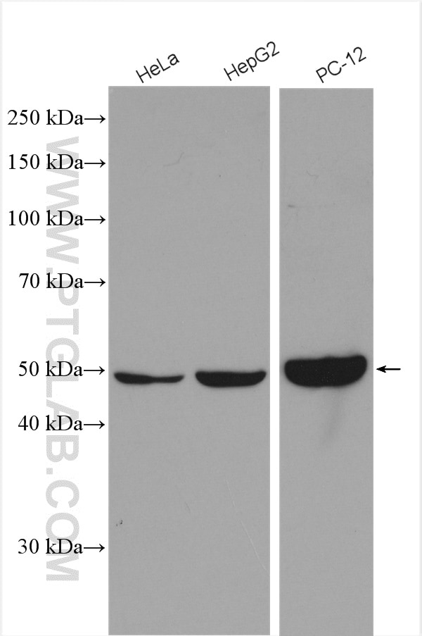 Western Blot (WB) analysis of various lysates using PIP4K2C Polyclonal antibody (17077-1-AP)