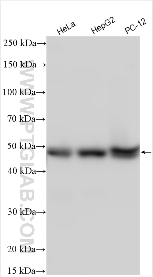 Western Blot (WB) analysis of various lysates using PIP4K2C Polyclonal antibody (17077-1-AP)