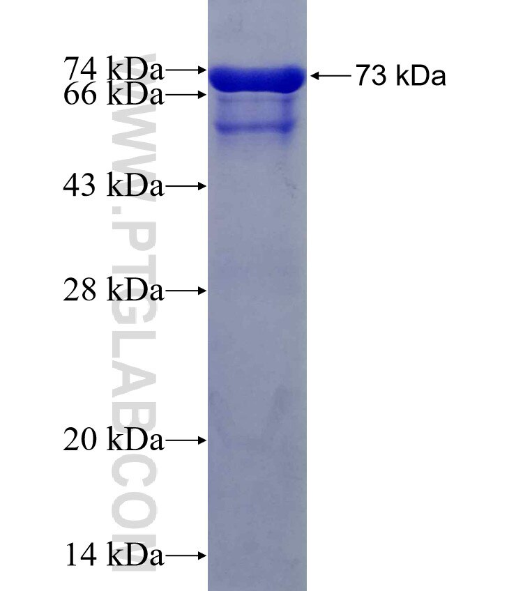 PIP4K2C fusion protein Ag10989 SDS-PAGE