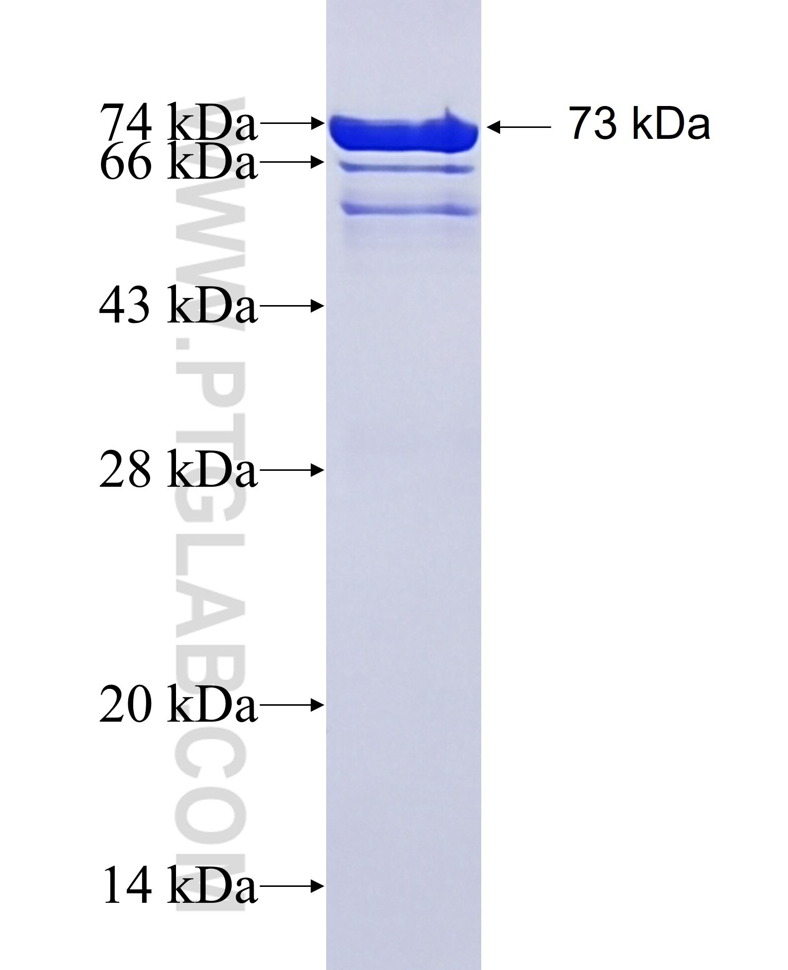 PIP4K2C fusion protein Ag10989 SDS-PAGE