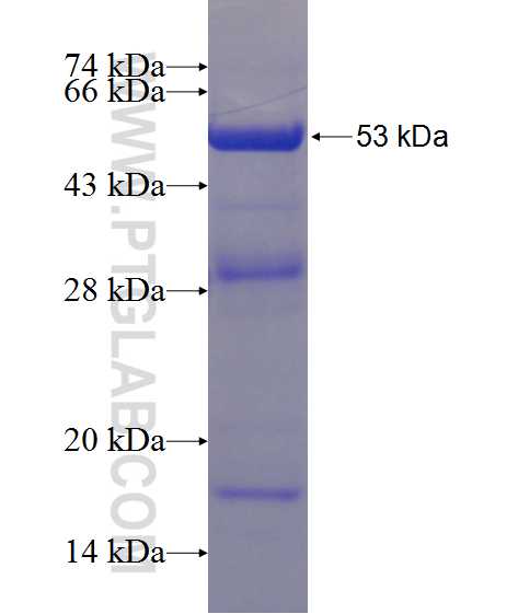 PIP4K2C fusion protein Ag11198 SDS-PAGE