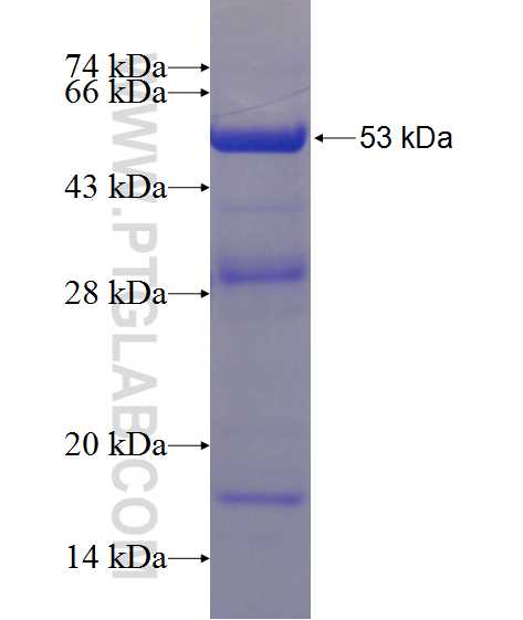 PIP4K2C fusion protein Ag11198 SDS-PAGE