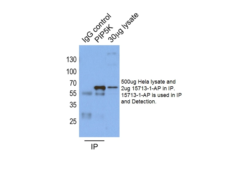 Immunoprecipitation (IP) experiment of HeLa cells using PIP5K1A Polyclonal antibody (15713-1-AP)