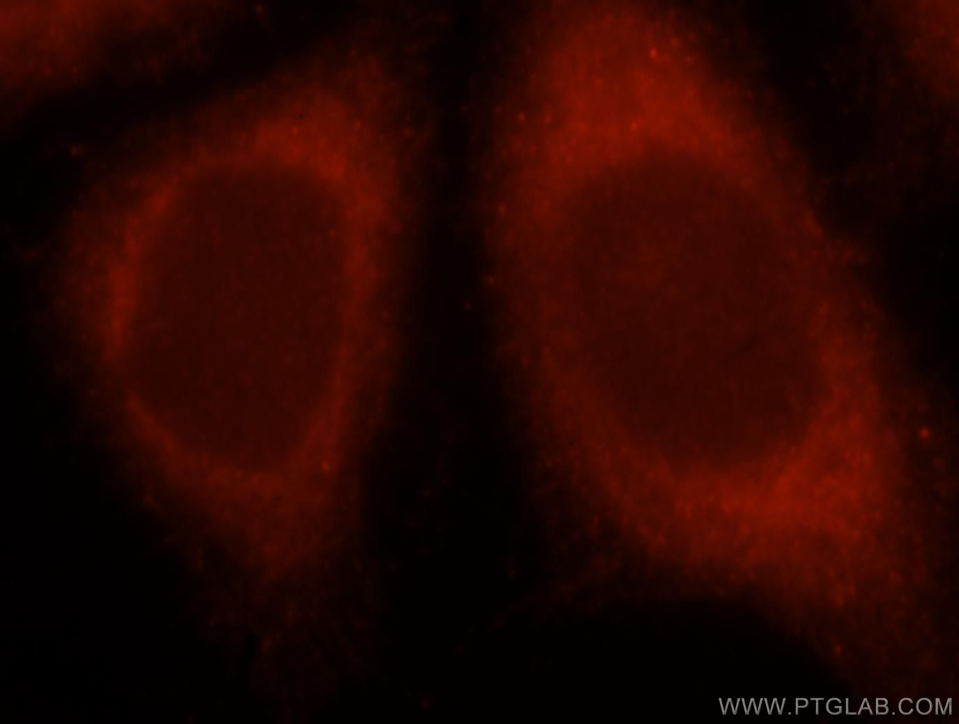 Immunofluorescence (IF) / fluorescent staining of HeLa cells using PIP5K1A Polyclonal antibody (15713-1-AP)